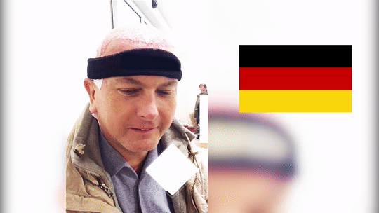 Haartransplantation Türkei - Zürich Klinik Istanbul - Beste Haarklinik für Prominente Haartransplantation Türkei - Zürich Klinik Istanbul - Beste Haarklinik für Prominente