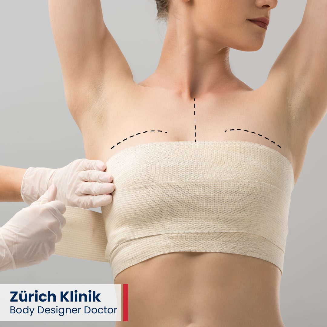 Brust OP - Brustvergrösserung - Brustverkleinerung -Bruststraffung op in der Türkei - Zürich Klinik Istanbul Brust OP Brustvergroesserung Brustverkleinerung Bruststraffung op in der Tuerkei Zuerich Klinik Istanbul